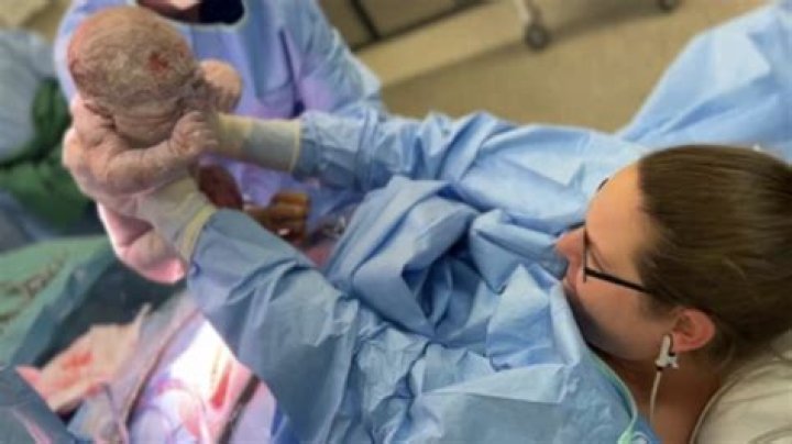 Are C-section babies smarter?