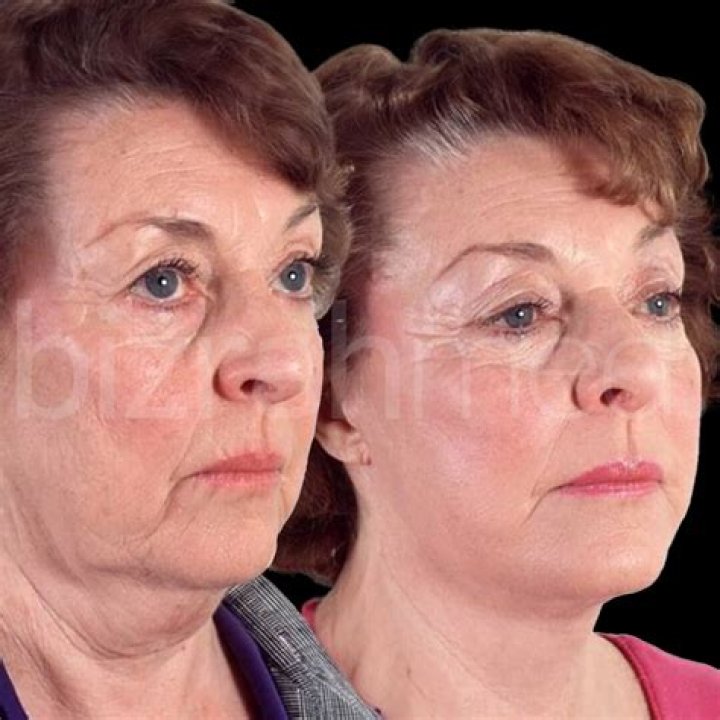 Can a 58 year old woman get in shape?