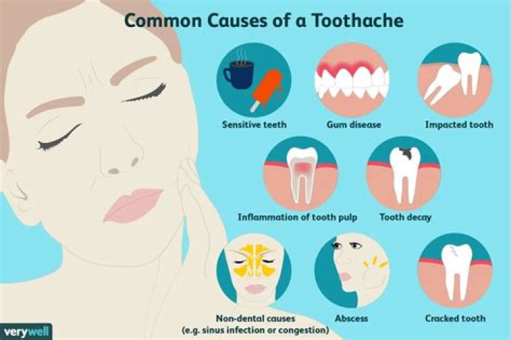 Can a toothache last for months?