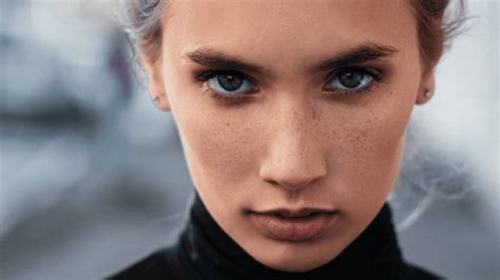 Can coconut oil cause pimples?
