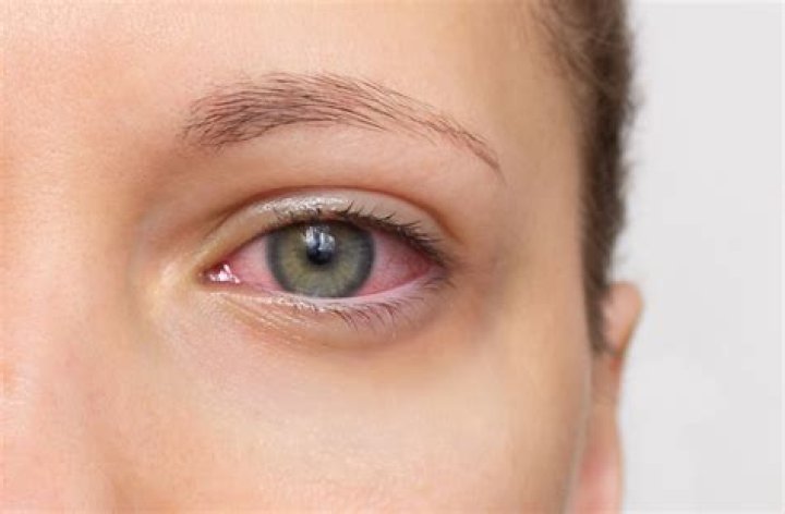 Can dry eye cause blind spots?