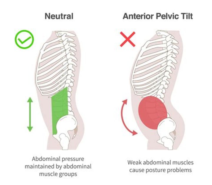 Can Weak pelvic floor cause bed-wetting?