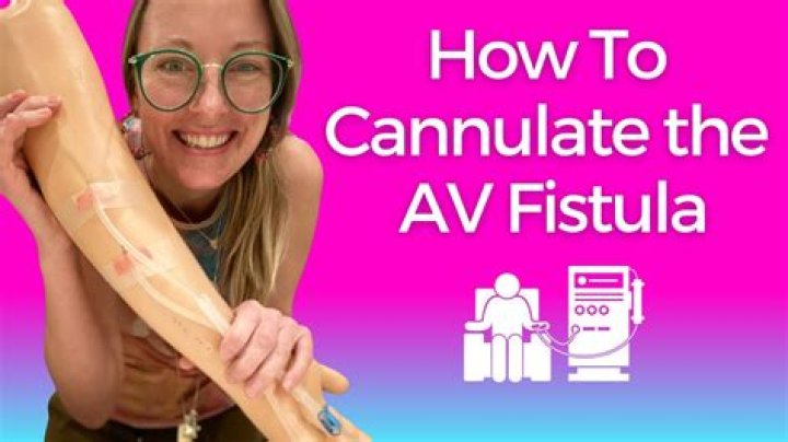 Can you feel a fistula with your finger?