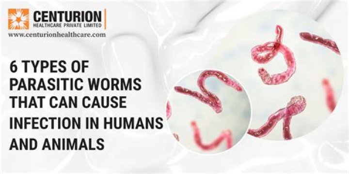 Can you test for worms in humans?