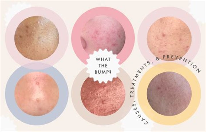 Do all pores have hair?