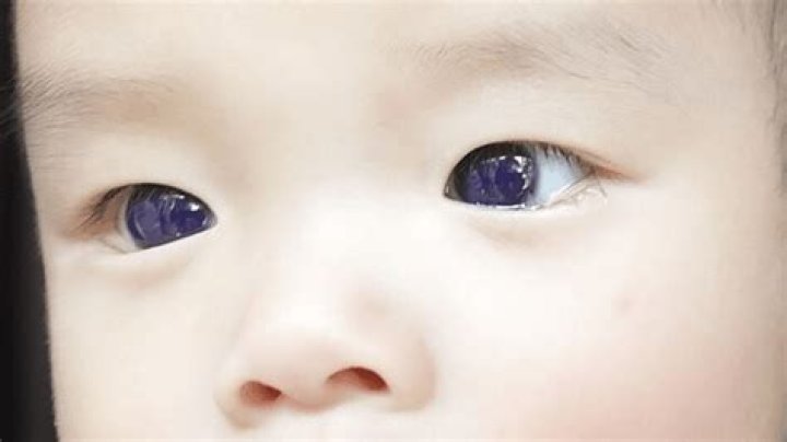 Do Scott's eyes turn blue?
