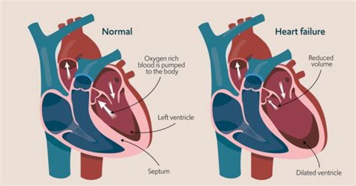 Does clapping help the heart?