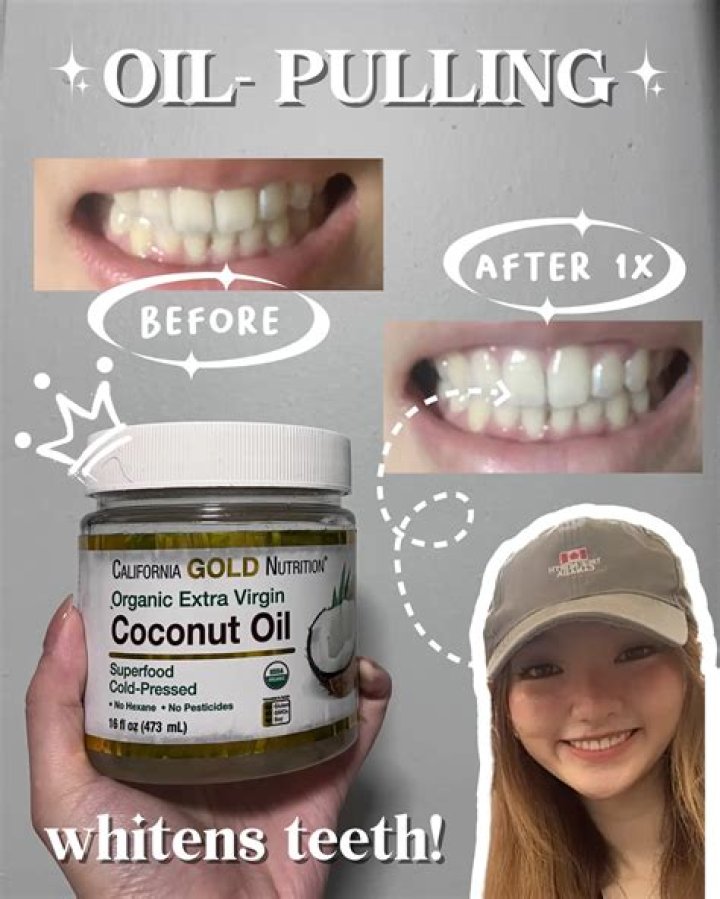 Does coconut pulling really whiten teeth?