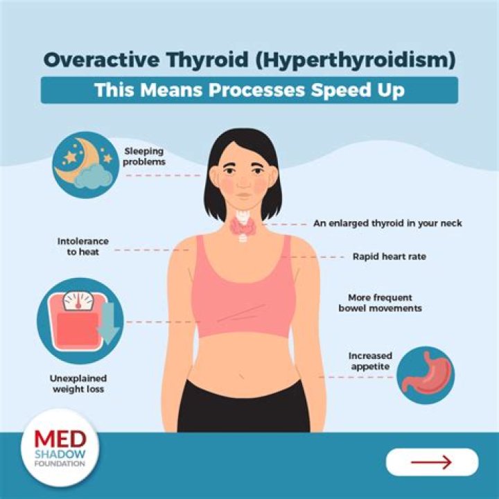 Does hypothyroidism affect sleep?