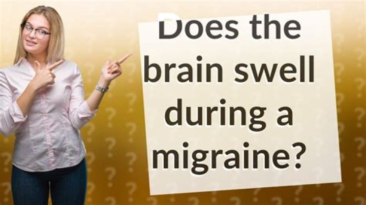 Does the brain swell during a migraine?