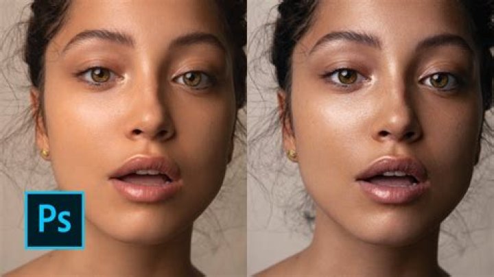 How can I have perfect skin?