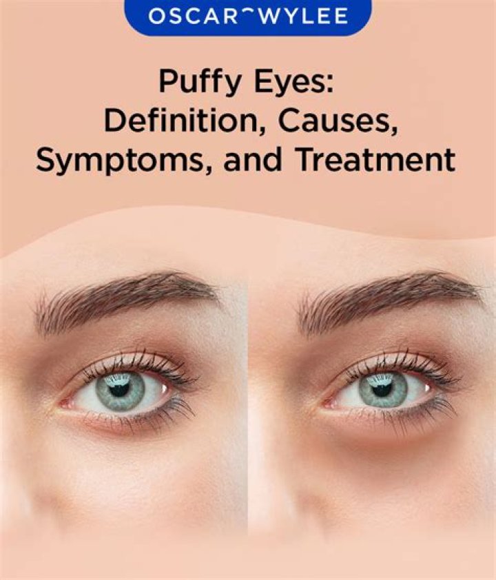 How can I wake up without puffy face?