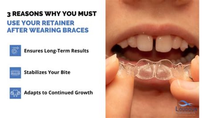 How do I get the white stuff off my retainer?