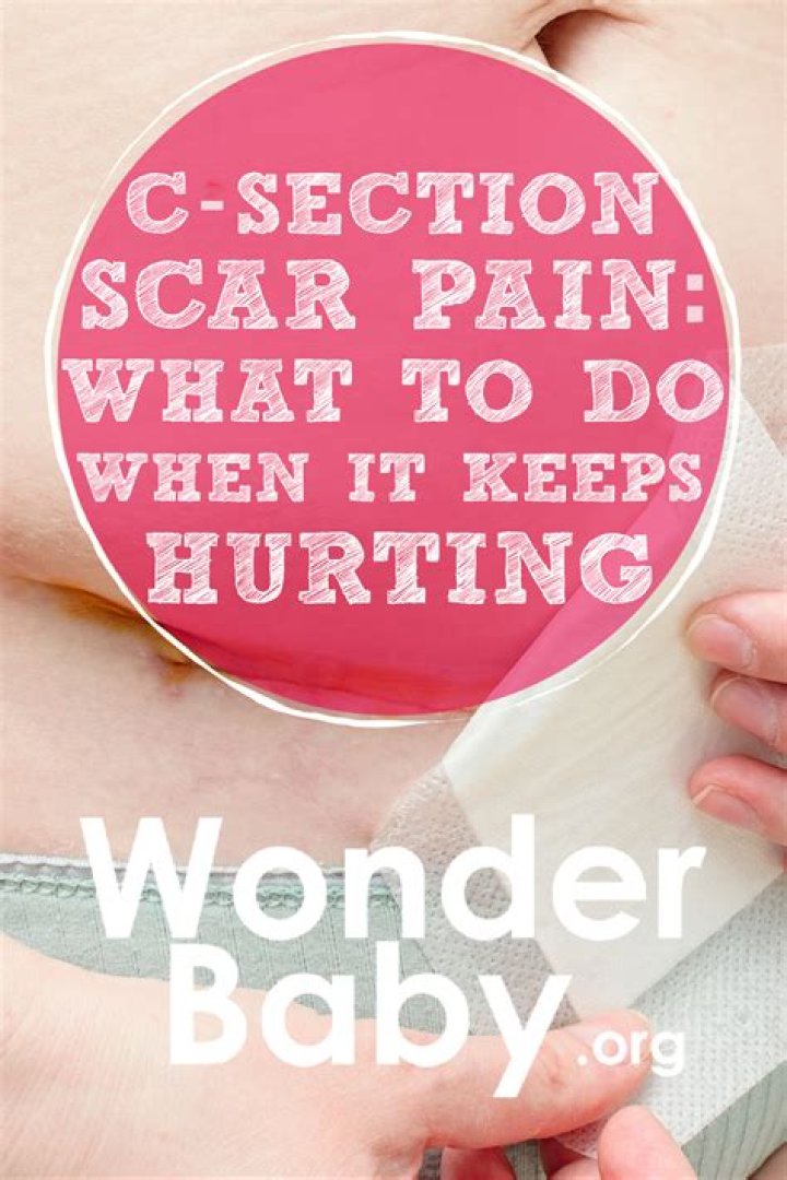 How do I know when my C-section is healed?