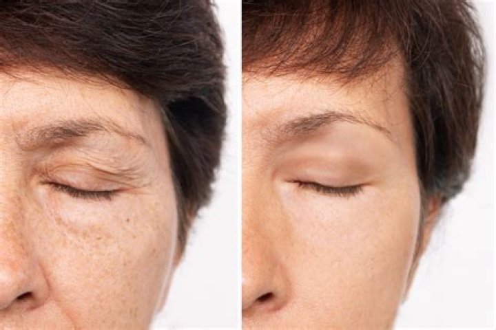 How do you make white scars less noticeable?