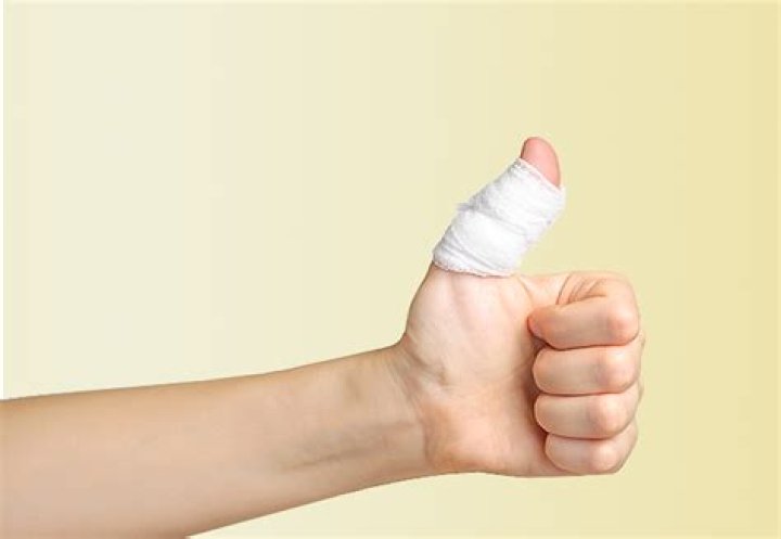 How long does a jammed finger last?