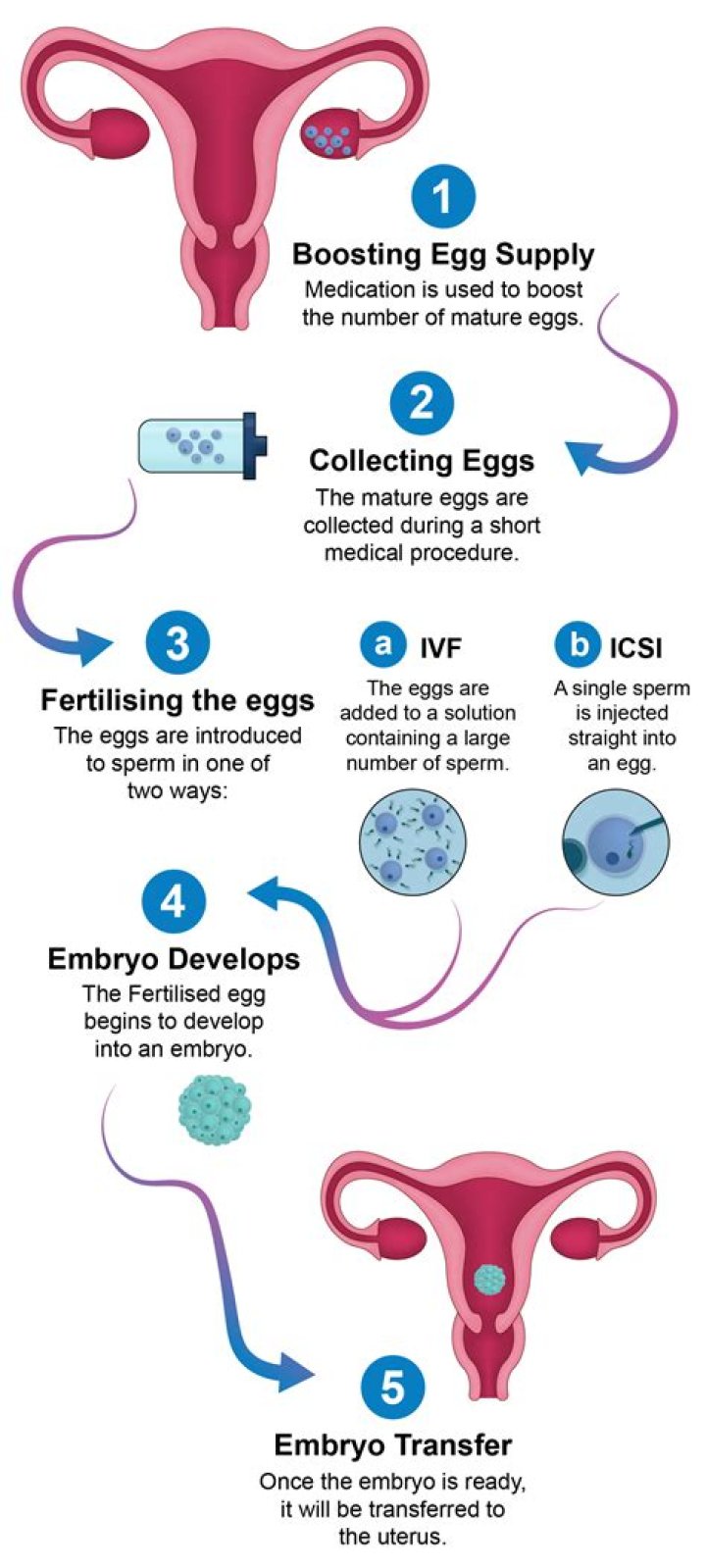 How long does ICSI IVF treatment take?