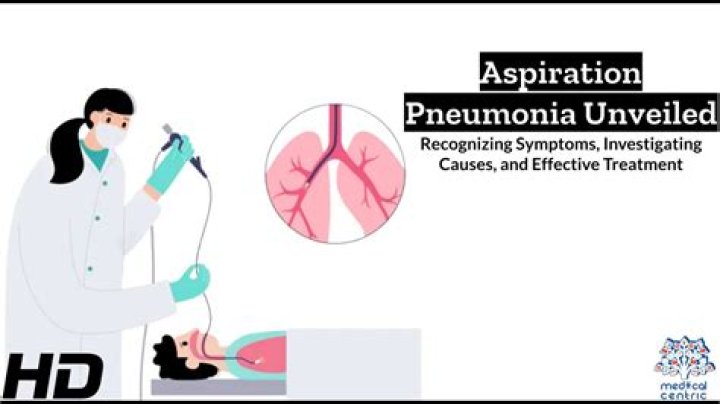 How long does it take for aspiration pneumonia to develop?