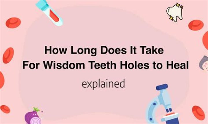 How long does it take for wisdom teeth holes to heal?
