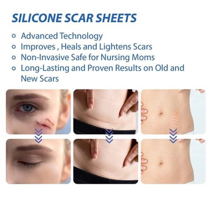 How long should I wear silicone sheets?