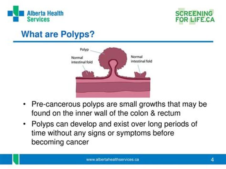 How serious is a precancerous polyp?