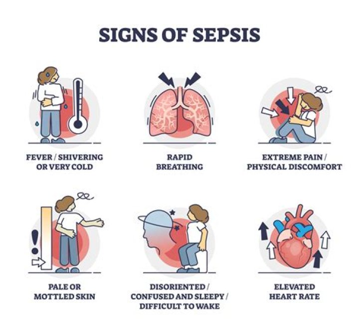 Is death by sepsis painful?