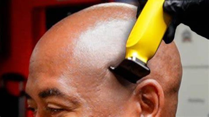 Is it OK to shave back hair?