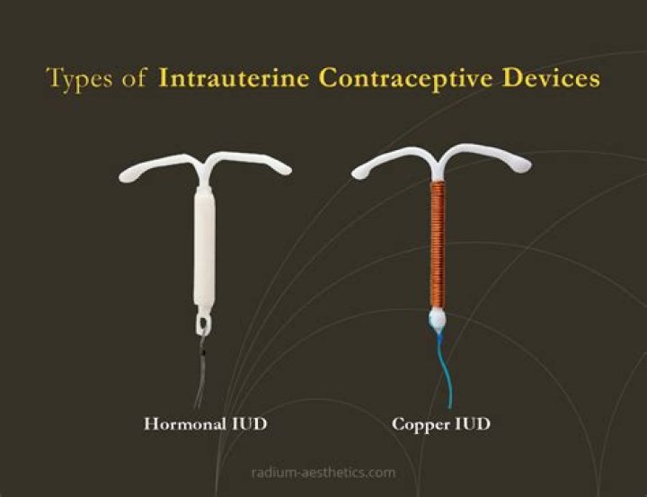Is IUD The best contraceptive?