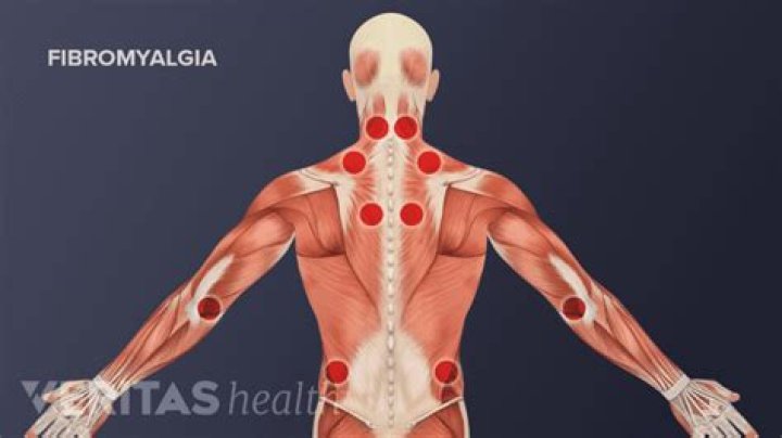 Should I go to the ER for fibromyalgia pain?