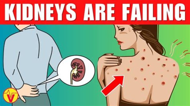 What are signs your kidneys are failing?