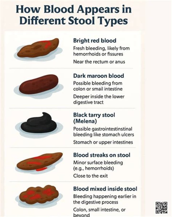 What color is blood in stool?