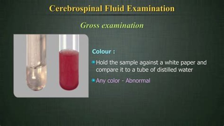 What Colour is brain fluid?