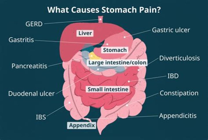 What do stomach spasms feel like?