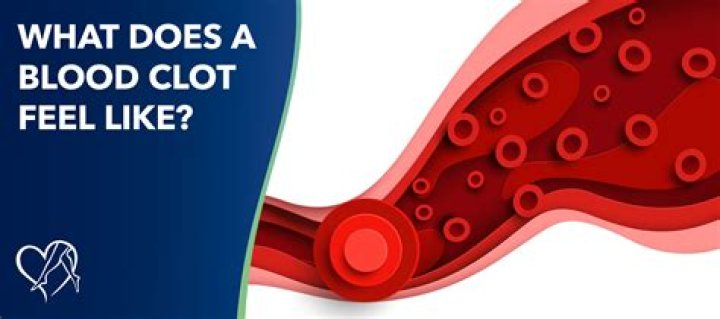 What does it feel like when blood clots move?