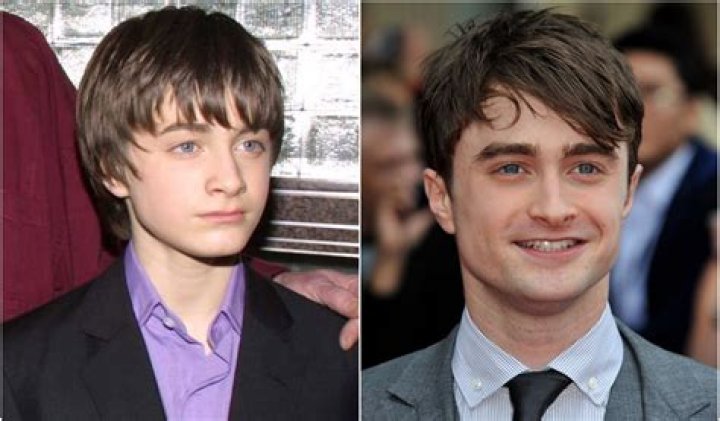 What is Daniel Radcliffe illness?