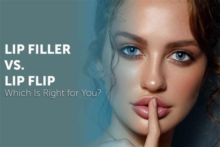 What is priming filler?