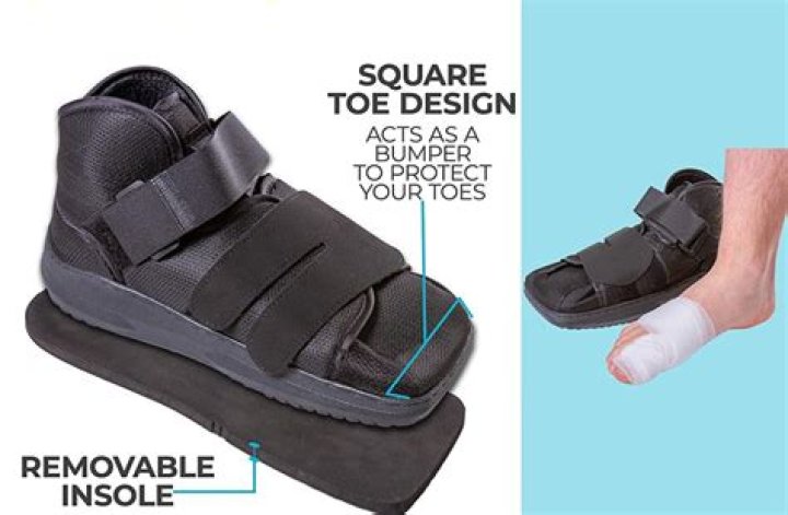 When can I wear regular shoes after bunion surgery?