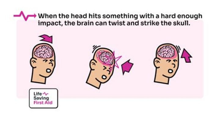 Why does my head scratch so much?