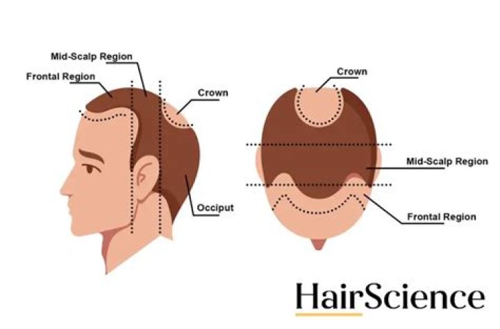 Why does the crown of my head hurt when I move my hair?
