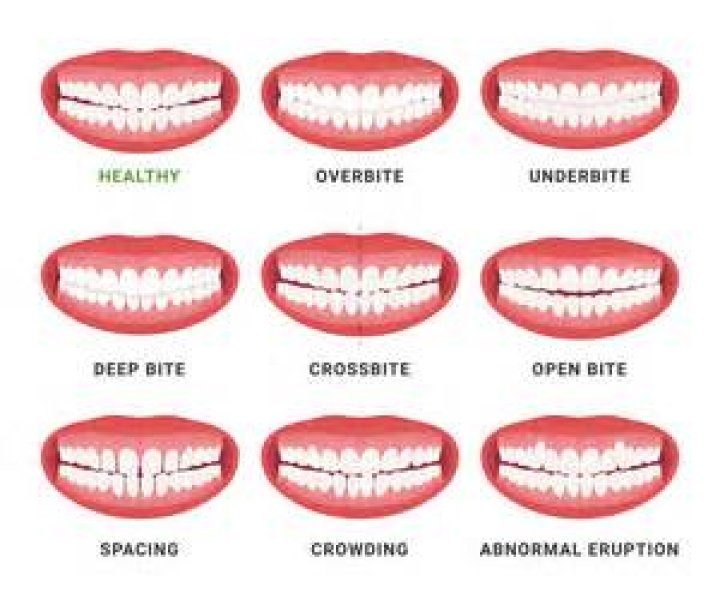 Will my teeth last my whole life?